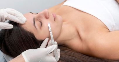 dermaplaning